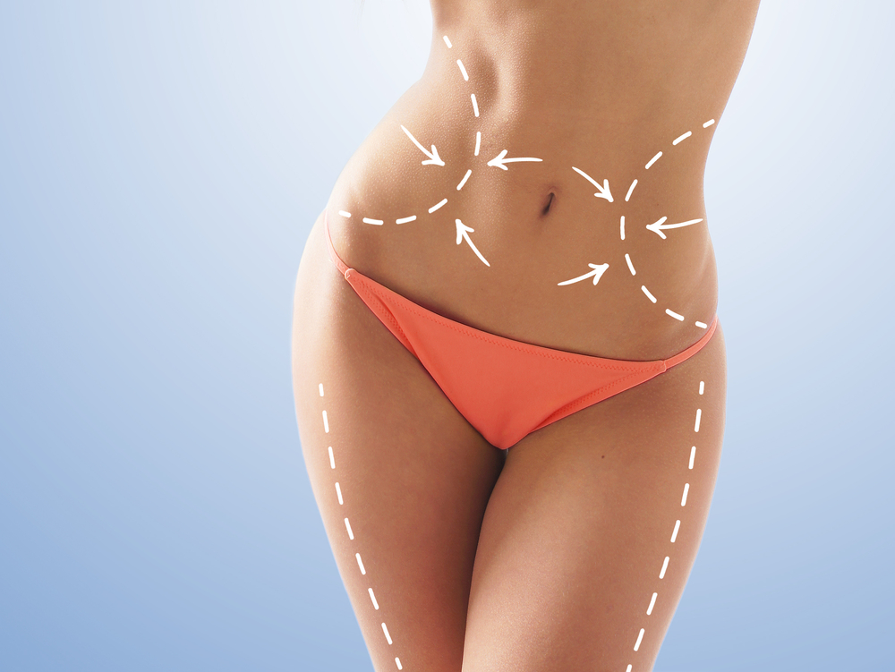 minimiser-douleurs-liposuccion